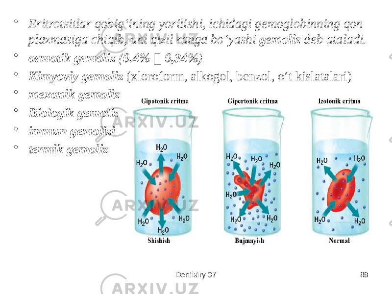 • Eritrotsitlar qobigʻining yorilishi, ichidagi gemoglobinning qon plazmasiga chiqib, uni qizil ranga boʻyashi gemoliz deb ataladi. • osmotik gemoliz (0.4%  0,34%) • Kimyoviy gemoliz (xloroform, alkogol, benzol, oʻt kislatalari) • mexanik gemoliz • Biologik gemoliz • immun gemolizi • termik gemoliz Dentistry 07 89 