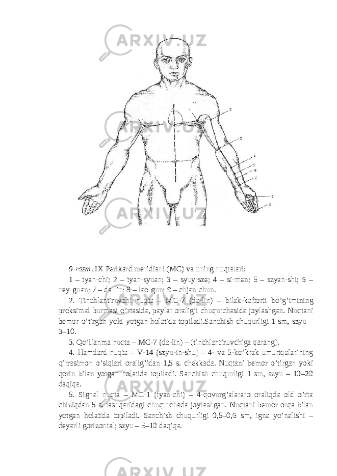  9-rasm. IX Perikard meridiani (MC) va uning nuqtalari: 1 – tyan-chi; 2 – tyan-syuan; 3 – syuy-sze; 4 – si-men; 5 – szyan-shi; 6 – ney-guan; 7 – da-lin; 8 – lao-gun; 9 – chjan-chun. 2. Tinchlantiruvchi nu q ta – M C -7 (da-lin) – bilak-kaftorti b o’g’ imining proksimal burmasi o’ rtasida, paylar orali g’ i chu q urchasida joylashgan. Nu q tani bemor o’ tirgan yoki yotgan h olatida topiladi.Sanchish chu q urligi 1 sm, szyu – 3–10. 3. Qo’ llanma nu q ta – M C -7 (da-lin) – (tinchlantiruvchiga q arang). 4. Hamdard nuqta – V-14 (szyu-in-shu) – 4- va 5-ko’krak umurtqalarining qirrasimon o’siqlari oralig’idan 1,5 s. chekkada. Nuqtani bemor o’tirgan yoki qorin bilan yotgan holatida topiladi. Sanchish chuqurligi 1 sm, szyu – 10–20 daqiqa. 5. Signal nuqta – MC-1 (tyan-chi) – 4-qovurg’alararo oraliqda old o’rta chiziqdan 5 s. tashqaridagi chuqurchada joylashgan. Nuqtani bemor orqa bilan yotgan holatida topiladi. Sanchish chuqurligi 0,5–0,6 sm, igna yo’nalishi – deyarli gorizontal; szyu – 5–10 daqiqa. 