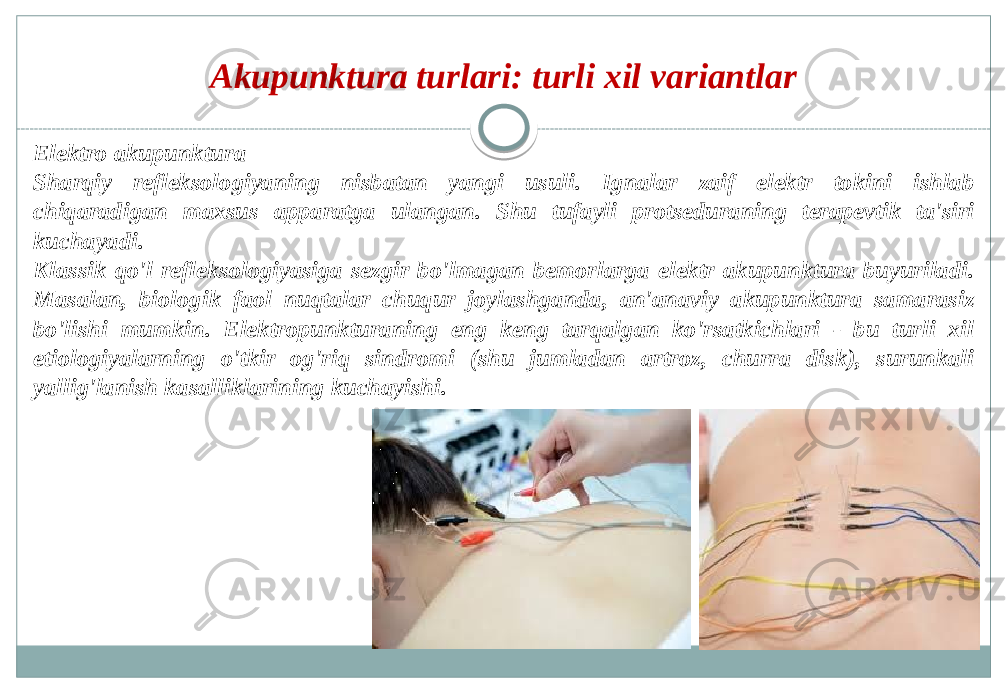 Akupunktura turlari: turli xil variantlar Elektro akupunktura Sharqiy refleksologiyaning nisbatan yangi usuli. Ignalar zaif elektr tokini ishlab chiqaradigan maxsus apparatga ulangan. Shu tufayli protseduraning terapevtik ta&#39;siri kuchayadi. Klassik qo&#39;l refleksologiyasiga sezgir bo&#39;lmagan bemorlarga elektr akupunktura buyuriladi. Masalan, biologik faol nuqtalar chuqur joylashganda, an&#39;anaviy akupunktura samarasiz bo&#39;lishi mumkin. Elektropunkturaning eng keng tarqalgan ko&#39;rsatkichlari - bu turli xil etiologiyalarning o&#39;tkir og&#39;riq sindromi (shu jumladan artroz, churra disk), surunkali yallig&#39;lanish kasalliklarining kuchayishi. 