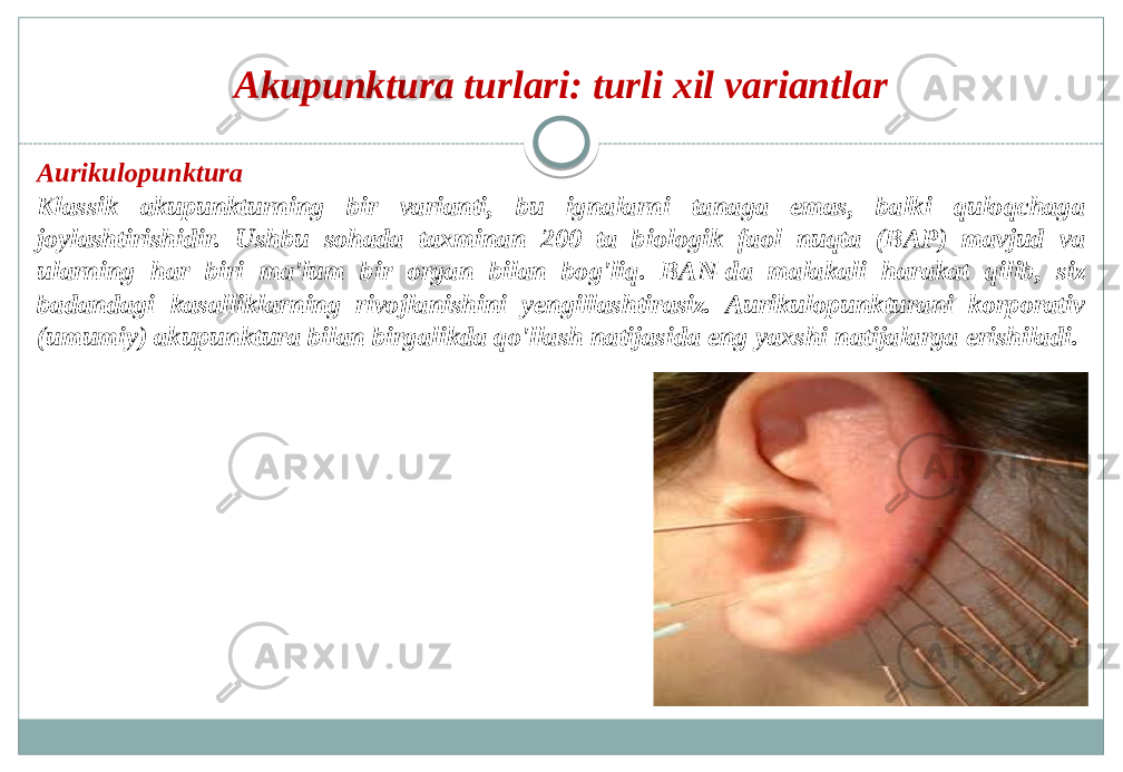 Akupunktura turlari: turli xil variantlar Aurikulopunktura Klassik akupunkturning bir varianti, bu ignalarni tanaga emas, balki quloqchaga joylashtirishidir. Ushbu sohada taxminan 200 ta biologik faol nuqta (BAP) mavjud va ularning har biri ma&#39;lum bir organ bilan bog&#39;liq. BAN-da malakali harakat qilib, siz badandagi kasalliklarning rivojlanishini yengillashtirasiz. Aurikulopunkturani korporativ (umumiy) akupunktura bilan birgalikda qo&#39;llash natijasida eng yaxshi natijalarga erishiladi. 