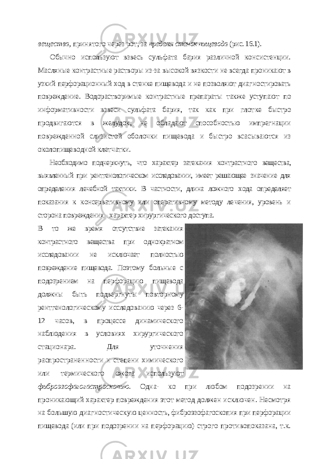 вещества, принятого через рот, за пределы стенок пищевода (рис. 16.1). Обычно используют взвесь сульфата бария различной консистенции. Масляные контрастные растворы из-за высокой вязкости не всегда прони кают в узкий перфорационный ход в стенке пищевода и не позволяют диаг ностировать повреждение. Водорастворимые контрастные препараты так же уступают по информативности взвеси сульфата бария, так как при глот ке быстро продвигаются в желудок, не обладают способностью импрегна ции поврежденной слизистой оболочки пищевода и быстро всасываются из околопищеводной клетчатки. Необходимо подчеркнуть, что характер затекания контрастного веще ства, выявленный при рентгенологическом исследовании, имеет решающее значение для определения лечебной тактики. В частности, длина ложного хода определяет показания к консервативному или оперативному методу ле чения, уровень и сторона повреждения - характер хирургического доступа. В то же время отсутствие затекания контрастного вещества при одно кратном исследовании не исключает полностью повреждение пищевода. Поэтому больные с подозрением на перфорацию пищевода должны быть подвергнуты повторному рентгенологическому исследованию через 6- 12 часов, в процессе динамического наблюдения в условиях хирургического стационара. Для уточнения распространенности и степени химического или термического ожога используют фиброэзофагогастроскопию. Одна- ко при любом подозрении на проникающий характер повреждения этот метод должен исключен. Несмотря на большую диагностическую цен ность, фиброэзофагоскопия при перфорации пищевода (или при подозре нии на перфорацию) строго противопоказана, т.к. 