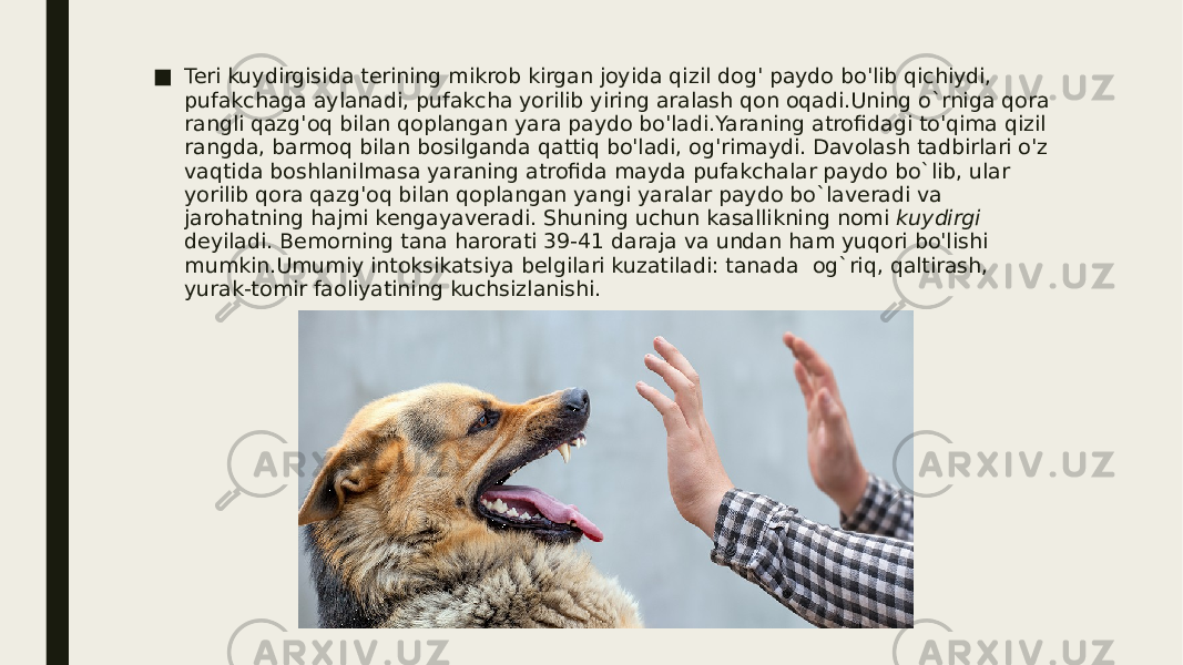 ■ Teri kuydirgisida terining mikrob kirgan joyida qizil dog&#39; paydo bo&#39;lib qichiydi, pufakchaga aylanadi, pufakcha yorilib yiring aralash qon oqadi.Uning o`rniga qora rangli qazg&#39;oq bilan qoplangan yara paydo bo&#39;ladi.Yaraning atrofidagi to&#39;qima qizil rangda, barmoq bilan bosilganda qattiq bo&#39;ladi, og&#39;rimaydi. Davolash tadbirlari o&#39;z vaqtida boshlanilmasa yaraning atrofida mayda pufakchalar paydo bo`lib, ular yorilib qora qazg&#39;oq bilan qoplangan yangi yaralar paydo bo`laveradi va jarohatning hajmi kengayaveradi. Shuning uchun kasallikning nomi kuydirgi deyiladi. Bemorning tana harorati 39-41 daraja va undan ham yuqori bo&#39;lishi mumkin.Umumiy intoksikatsiya belgilari kuzatiladi: tanada og`riq, qaltirash, yurak-tomir faoliyatining kuchsizlanishi. 