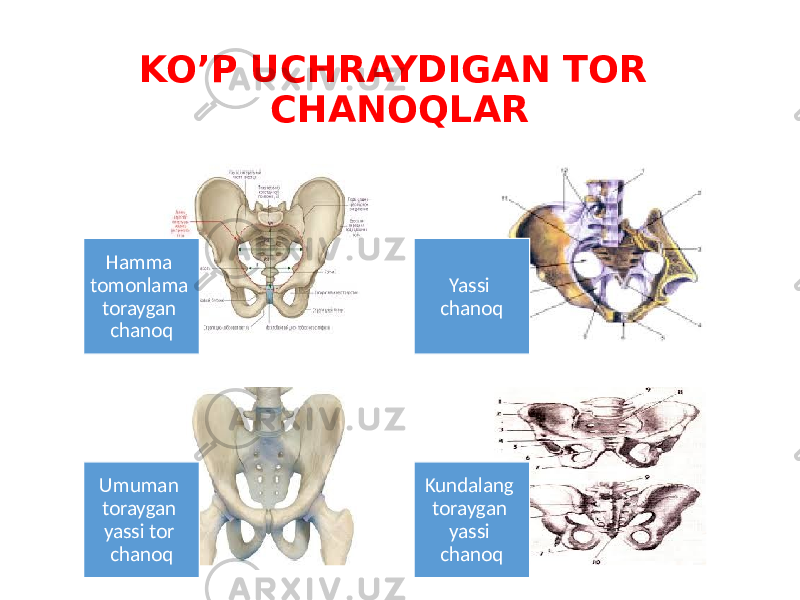 KO’P UCHRAYDIGAN TOR CHANOQLAR Hamma tomonlama toraygan chanoq Yassi chanoq Umuman toraygan yassi tor chanoq Kundalang toraygan yassi chanoq 