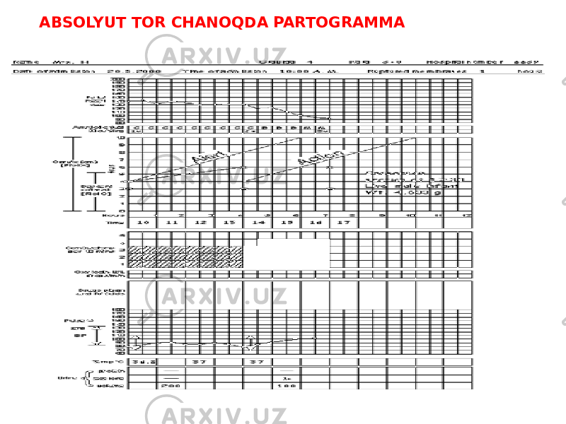 ABSOLYUT TOR CHANOQDA PARTOGRAMMA 