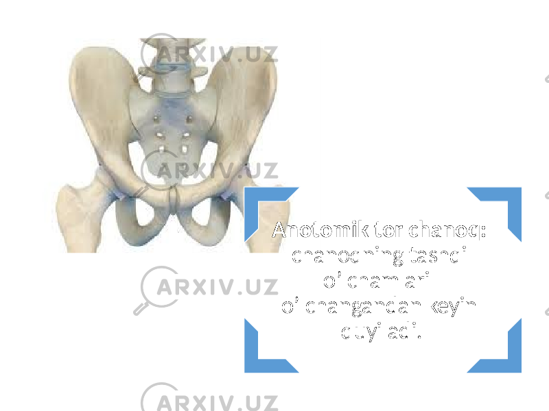 Anotomik tor chanoq: chanoqning tashqi o’lchamlari o’lchangandan keyin quyiladi. 