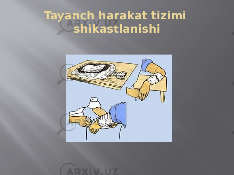 Tayanch harakat tizimi shikastlanishi 