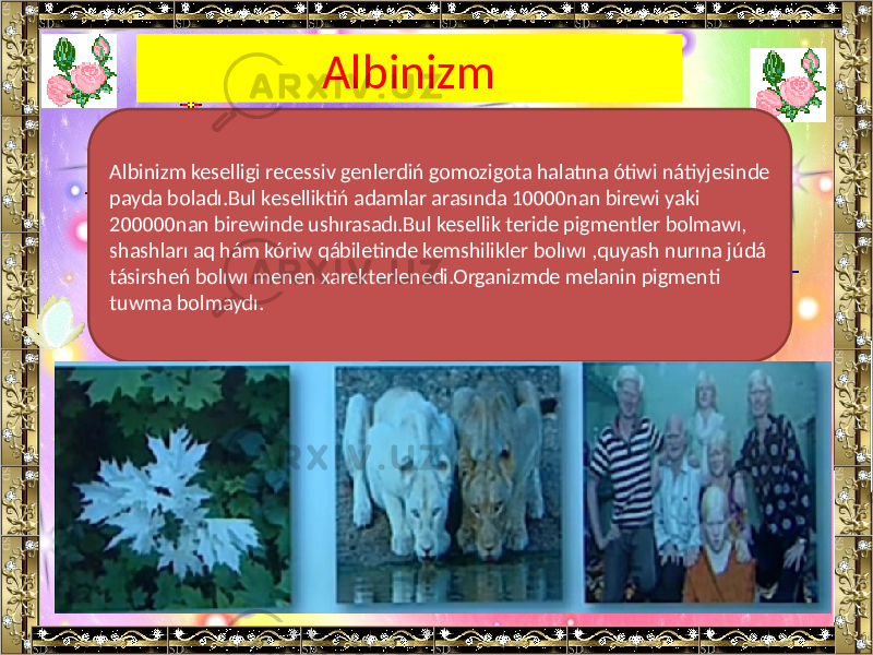 Albinizm Albinizm keselligi recessiv genlerdiń gomozigota halatına ótiwi nátiyjesinde payda boladı.Bul keselliktiń adamlar arasında 10000nan birewi yaki 200000nan birewinde ushırasadı.Bul kesellik teride pigmentler bolmawı, shashları aq hám kóriw qábiletinde kemshilikler bolıwı ,quyash nurına júdá tásirsheń bolıwı menen xarekterlenedi.Organizmde melanin pigmenti tuwma bolmaydı. 