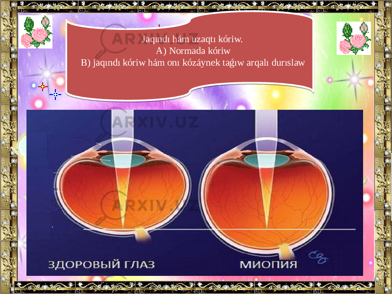  Jaqındı hám uzaqtı kóriw. A) Normada kóriw B) jaqındı kóriw hám onı kózáynek taǵıw arqalı durıslaw09 49 252909 0F 