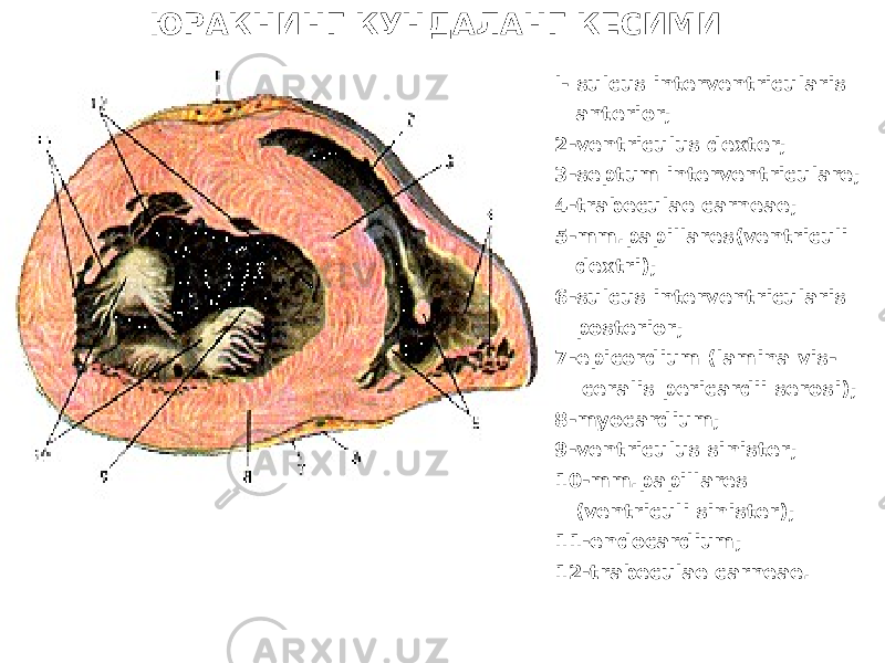 ЮРАКНИНГ КУНДАЛАНГ КЕСИМИ l- sulcus interventricularis anterior; 2-ventriculus dexter; 3-septum interventriculare; 4-trabeculae carneae; 5-mm.papillares(ventriculi dextri); 6-sulcus interventricularis posterior; 7-epicordium (lamina vis- ceralis pericardii serosi); 8-myocardium; 9-ventriculus sinister; 10-mm.papillares (ventriculi sinister); 11-endocardium; 12-trabeculae carneae. 