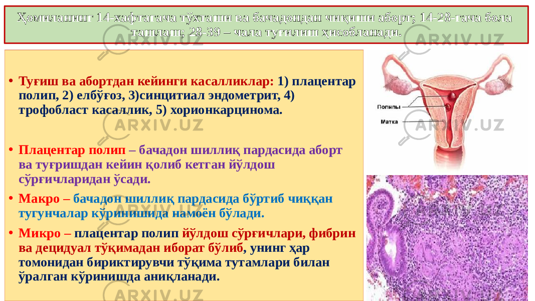 • Туғиш ва абортдан кейинги касалликлар: 1) плацентар полип, 2) елбўғоз, 3)синцитиал эндометрит, 4) трофобласт касаллик, 5) хорионкарцинома. • Плацентар полип – бачадон шиллиқ пардасида аборт ва туғришдан кейин қолиб кетган йўлдош сўрғичларидан ўсади. • Макро – бачадон шиллиқ пардасида бўртиб чиққан тугунчалар кўринишида намоён бўлади. • Микро – плацентар полип йўлдош сўрғичлари, фибрин ва децидуал тўқимадан иборат бўлиб , унинг ҳар томонидан бириктирувчи тўқима тутамлари билан ўралган кўринишда аниқланади.Ҳомиланинг 14-хафтагача тўхташи ва бачадондан чиқиши аборт; 14-28-гача бола ташлаш; 28-39 – чала туғилиш ҳисобланади. 