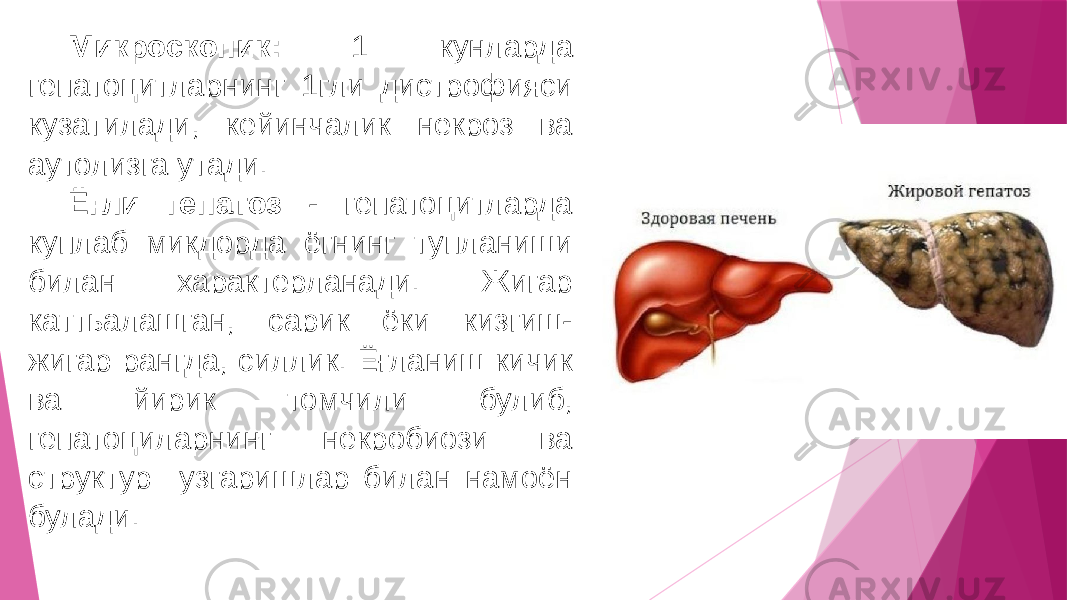 Микроскопик: 1 кунларда гепатоцитларнинг 1гли дистрофияси кузатилади, кейинчалик некроз ва аутолизга утади. Ёғли гепатоз - гепатоцитларда куплаб микдорда ёгнинг тупланиши билан характерланади. Жигар каттьалашган, сарик ёки кизгиш- жигар рангда, силлик. Ёғланиш кичик ва йирик томчили булиб, гепатоциларнинг некробиози ва структур узгаришлар билан намоён булади. 