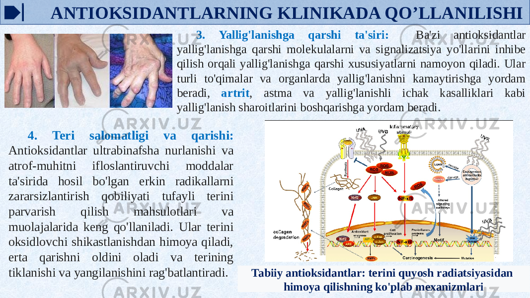  ANTIOKSIDANTLARNING KLINIKADA QO’LLANILISHI 3. Yallig&#39;lanishga qarshi ta&#39;siri: Ba&#39;zi antioksidantlar yallig&#39;lanishga qarshi molekulalarni va signalizatsiya yo&#39;llarini inhibe qilish orqali yallig&#39;lanishga qarshi xususiyatlarni namoyon qiladi. Ular turli to&#39;qimalar va organlarda yallig&#39;lanishni kamaytirishga yordam beradi, artrit , astma va yallig&#39;lanishli ichak kasalliklari kabi yallig&#39;lanish sharoitlarini boshqarishga yordam beradi. 4. Teri salomatligi va qarishi: Antioksidantlar ultrabinafsha nurlanishi va atrof-muhitni ifloslantiruvchi moddalar ta&#39;sirida hosil bo&#39;lgan erkin radikallarni zararsizlantirish qobiliyati tufayli terini parvarish qilish mahsulotlari va muolajalarida keng qo&#39;llaniladi. Ular terini oksidlovchi shikastlanishdan himoya qiladi, erta qarishni oldini oladi va terining tiklanishi va yangilanishini rag&#39;batlantiradi. Tabiiy antioksidantlar: terini quyosh radiatsiyasidan himoya qilishning ko&#39;plab mexanizmlari 