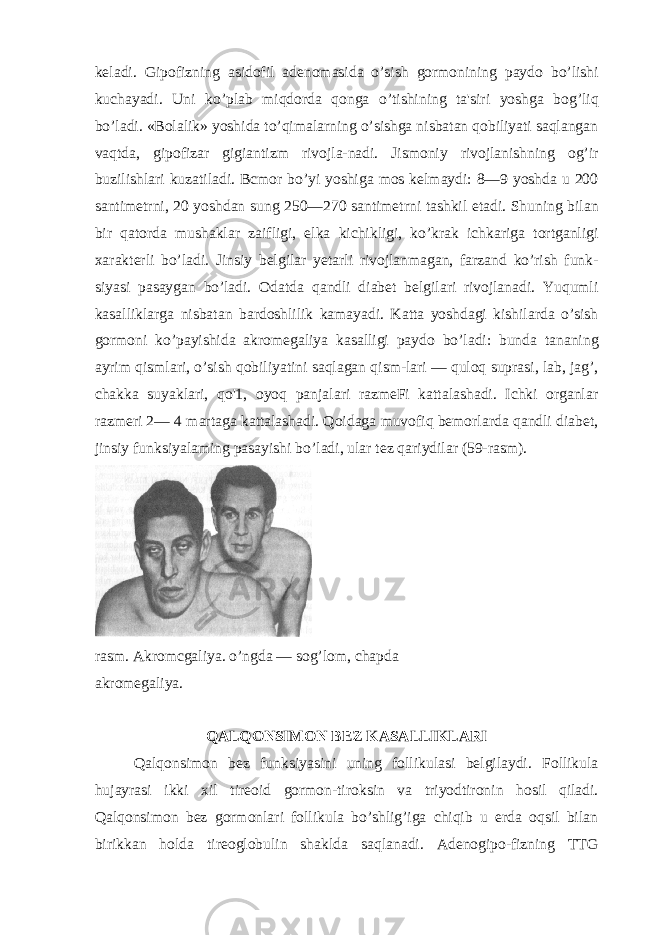 keladi. Gipofizning asidofil adenomasida o’sish gormonining paydo bo’lishi kuchayadi. Uni ko’plab miqdorda qonga o’tishining ta&#39;siri yoshga bog’liq bo’ladi. «Bolalik» yoshida to’qimalarning o’sishga nisbatan qobiliyati saqlangan vaqtda, gipofizar gigiantizm rivojla-nadi. Jismoniy rivojlanishning og’ir buzilishlari kuzatiladi. Bcmor bo’yi yoshiga mos kelmaydi: 8—9 yoshda u 200 santimetrni, 20 yoshdan sung 250—270 santimetrni tashkil etadi. Shuning bilan bir qatorda mushaklar zaifligi, elka kichikligi, ko’krak ichkariga tortganligi xarakterli bo’ladi. Jinsiy belgilar yetarli rivojlanmagan, farzand ko’rish funk- siyasi pasaygan bo’ladi. Odatda qandli diabet belgilari rivojlanadi. Yuqumli kasalliklarga nisbatan bardoshlilik kamayadi. Katta yoshdagi kishilarda o’sish gormoni ko’payishida akromegaliya kasalligi paydo bo’ladi: bunda tananing ayrim qismlari, o’sish qobiliyatini saqlagan qism-lari — quloq suprasi, lab, jag’, chakka suyaklari, qo&#39;1, oyoq panjalari razmeFi kattalashadi. Ichki organlar razmeri 2— 4 martaga kattalashadi. Qoidaga muvofiq bemorlarda qandli diabet, jinsiy funksiyalaming pasayishi bo’ladi, ular tez qariydilar (59-rasm). rasm. Akromcgaliya. o’ngda — sog’lom, chapda akromegaliya. QALQONSIMON BEZ KASALLIKLARI Qalqonsimon bez funksiyasini uning follikulasi belgilaydi. Follikula hujayrasi ikki xil tireoid gormon-tiroksin va triyodtironin hosil qiladi. Qalqonsimon bez gormonlari follikula bo’shlig’iga chiqib u erda oqsil bilan birikkan holda tireoglobulin shaklda saqlanadi. Adenogipo-fizning TTG 