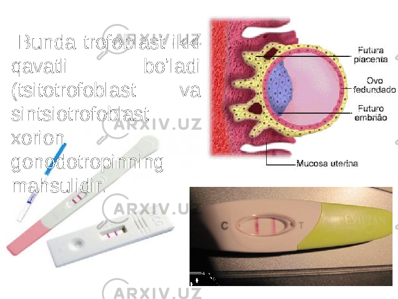  Bunda trofoblast ikki qavatli boʼladi (tsitotrofoblast va sintsiotrofoblast xorion gonodotropinning mahsulidir. 