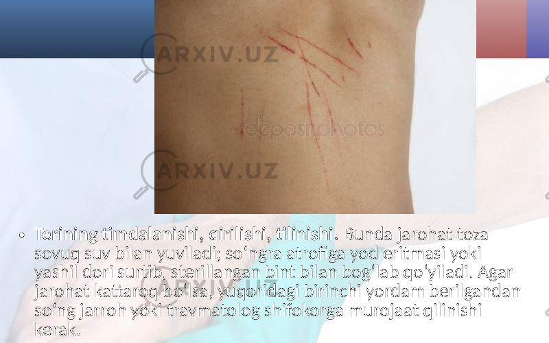 • Terining timdalanishi, qirilishi, tilinishi. Bunda jarohat toza sovuq suv bilan yuviladi; so‘ngra atrofiga yod eritmasi yoki yashil dori surtib, sterillangan bint bilan bog‘lab qo‘yiladi. Agar jarohat kattaroq bo‘lsa, yuqoridagi birinchi yordam berilgandan so‘ng jarroh yoki travmatolog shifokorga murojaat qilinishi kerak. 