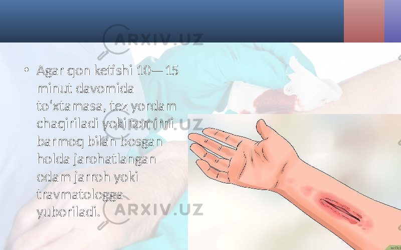 • Agar qon ketishi 10—15 minut davomida to‘xtamasa, tez yordam chaqiriladi yoki tomirni barmoq bilan bosgan holda jarohatlangan odam jarroh yoki travmatologga yuboriladi. 