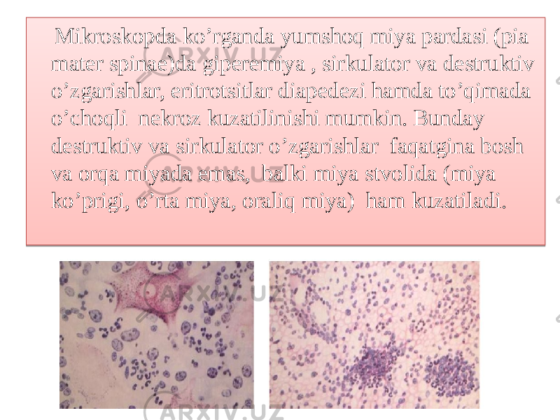  Mikroskopda ko’rganda yumshoq miya pardasi (pia mater spinae)da giperemiya , sirkulator va destruktiv o’zgarishlar, eritrotsitlar diapedezi hamda to’qimada o’choqli nekroz kuzatilinishi mumkin. Bunday destruktiv va sirkulator o’zgarishlar faqatgina bosh va orqa miyada emas, balki miya stvolida (miya ko’prigi, o’rta miya, oraliq miya) ham kuzatiladi. 07 2F 10 01 01 1B 18 04 