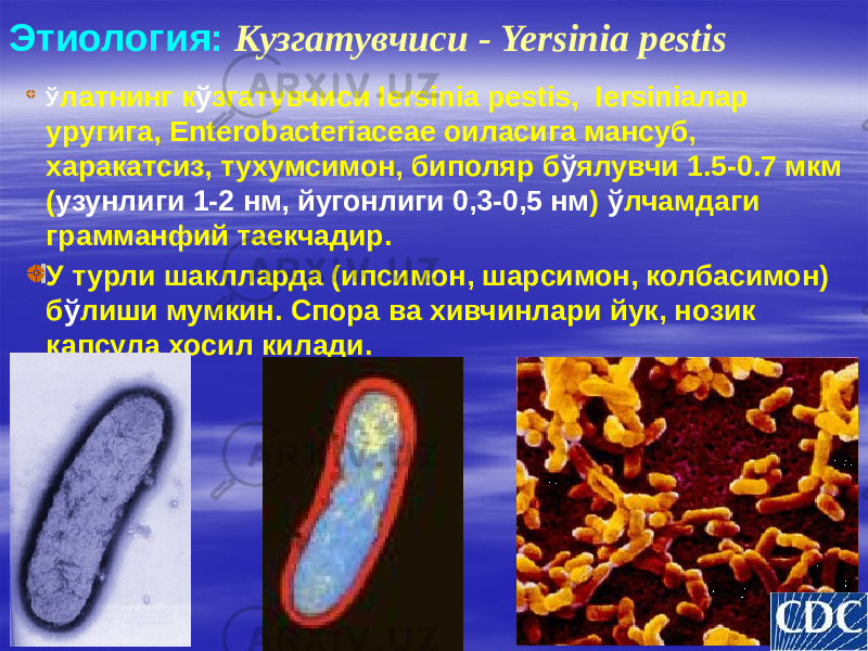 Этиология: Кузгатувчиси - Yersinia pestis Ў латнинг к ў згатувчиси Iersinia pestis, Iersiniaлар уругига, Enterobacteriaceae оиласига мансуб, харакатсиз, тухумсимон, биполяр б ў ялувчи 1.5-0.7 мкм ( узунлиги 1-2 нм, йугонлиги 0,3-0,5 нм ) ў лчамдаги грамманфий таекчадир. У турли шаклларда (ипсимон, шарсимон, колбасимон) б ў лиши мумкин. Спора ва хивчинлари йук, нозик капсула хосил килади. 