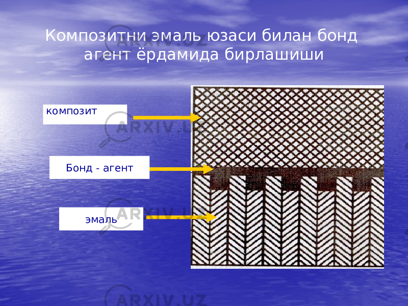 Композитни эмаль юзаси билан бонд агент ёрдамида бирлашиши композит Бонд - агент эмаль 