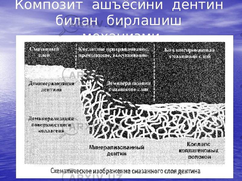 Композит ашъёсини дентин билан бирлашиш механизми Ёпишқоқ қават Кислота билан сингдириш, ювиш, қуритиш Коланслашган ёпишқоқ қават Дентиннинг деминерализацияси Юза коллаген қаватининг деминерализацияси Минераллашган дентин Коллаген толалар коллапси Ёпишқоқ дентин қатламининг схематик тасвири Ёпишқоқ қатламнинг деминерализацияси 