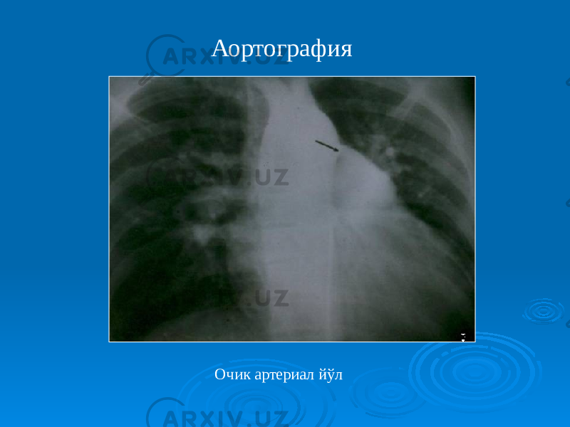 Очик артериал йўлАортография 