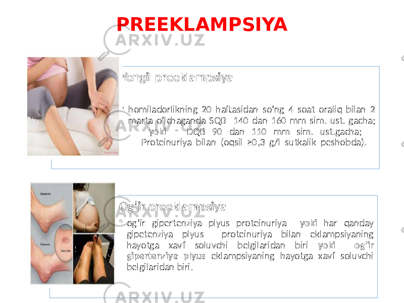 PREEKLAMPSIYA Yengil preeklampsiya • homiladorlikning 20 haftasidan so’ng 4 soat oraliq bilan 2 marta o’lchaganda SQB 140 dan 160 mm sim. ust. gacha; yoki DQB 90 dan 110 mm sim. ust.gacha; Proteinuriya bilan (oqsil ≥0,3 g/l sutkalik peshobda). Og’ir preeklampsiya • og’ir gipertenziya plyus proteinuriya yoki har qanday gipetenziya plyus proteinuriya bilan eklampsiyaning hayotga xavf soluvchi belgilaridan biri yoki og’ir gipertenziya plyus eklampsiyaning hayotga xavf soluvchi belgilaridan biri. 