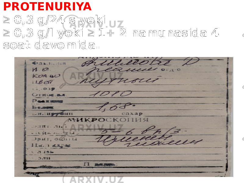 PROTENURIYA ≥ 0,3 g/24 s yoki ≥ 0,3 g/l yoki ≥ 1+ 2 namunasida 4 soat davomida. 