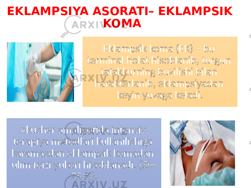 EKLAMPSIYA ASORATI– EKLAMPSIK KOMA Eklampsik koma (EK) – bu terminal holat hisoblanib, turgun tafakkurning buzilishi bilan harakterlanib, eklampsiyadan keyin yuzaga keladi. Akusher amaliyotida intensiv terapiya metodlari kullanilishiga karamasdan eklampsik komadan ulim foizi yukori hisoblanadi. (50- 75 %). 