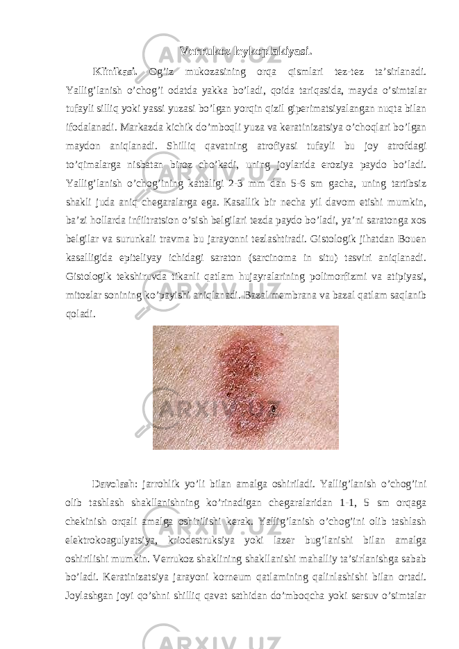 Verrukoz leykoplakiyasi. Klinikasi. Og’iz mukozasining orqa qismlari tez-tez ta’sirlanadi. Yallig’lanish o’chog’i odatda yakka bo’ladi, qoida tariqasida, mayda o’simtalar tufayli silliq yoki yassi yuzasi bo’lgan yorqin qizil giperimatsiyalangan nuqta bilan ifodalanadi. Markazda kichik do’mboqli yuza va keratinizatsiya o’choqlari bo’lgan maydon aniqlanadi. Shilliq qavatning atrofiyasi tufayli bu joy atrofdagi to’qimalarga nisbatan biroz cho’kadi, uning joylarida eroziya paydo bo’ladi. Yallig’lanish o’chog’ining kattaligi 2-3 mm dan 5-6 sm gacha, uning tartibsiz shakli juda aniq chegaralarga ega. Kasallik bir necha yil davom etishi mumkin, ba’zi hollarda infiltratsion o’sish belgilari tezda paydo bo’ladi, ya’ni saratonga xos belgilar va surunkali travma bu jarayonni tezlashtiradi. Gistologik jihatdan Bouen kasalligida epiteliyay ichidagi saraton (sarcinoma in situ) tasviri aniqlanadi. Gistologik tekshiruvda tikanli qatlam hujayralarining polimorfizmi va atipiyasi, mitozlar sonining ko’payishi aniqlanadi. Bazal membrana va bazal qatlam saqlanib qoladi. Davolash : jarrohlik yo’li bilan amalga oshiriladi. Yallig’lanish o’chog’ini olib tashlash shakllanishning ko’rinadigan chegaralaridan 1-1, 5 sm orqaga chekinish orqali amalga oshirilishi kerak. Yallig’lanish o’chog’ini olib tashlash elektrokoagulyatsiya, kriodestruksiya yoki lazer bug’lanishi bilan amalga oshirilishi mumkin. Verrukoz shaklining shakllanishi mahalliy ta’sirlanishga sabab bo’ladi. Keratinizatsiya jarayoni korneum qatlamining qalinlashishi bilan ortadi. Joylashgan joyi qo’shni shilliq qavat sathidan do’mboqcha yoki sersuv o’simtalar 