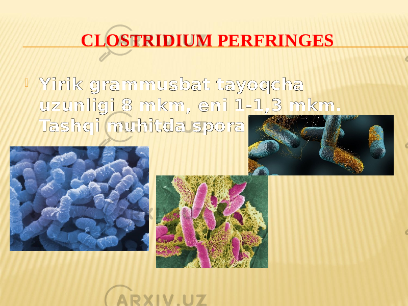 CLОSTRIDIUM PERFRINGES  Yirik grammusbat tayoqcha uzunligi 8 mkm, eni 1-1,3 mkm. Tashqi muhitda spora hosil qiladi 