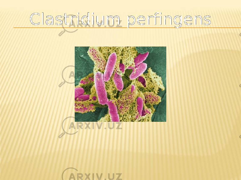 Clastridium perfingens 