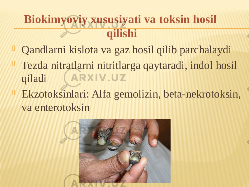 Biokimyoviy xususiyati va toksin hosil qilishi  Qandlarni kislota va gaz hosil qilib parchalaydi  Tezda nitratlarni nitritlarga qaytaradi, indol hosil qiladi  Ekzotoksinlari: Alfa gemolizin, beta-nekrotoksin, va enterotoksin 