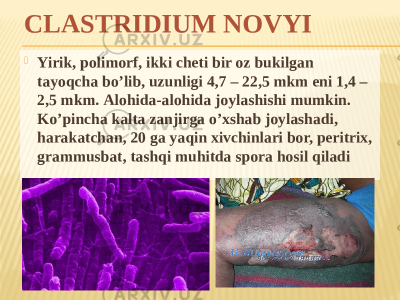 CLASTRIDIUM NOVYI  Yirik, polimorf, ikki cheti bir oz bukilgan tayoqcha boʼlib, uzunligi 4,7 – 22,5 mkm eni 1,4 – 2,5 mkm. Аlohida-alohida joylashishi mumkin. Koʼpincha kalta zanjirga oʼxshab joylashadi, harakatchan, 20 ga yaqin xivchinlari bor, peritrix, grammusbat, tashqi muhitda spora hosil qiladi 