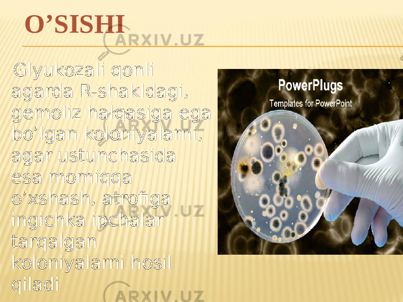 O’SISHI Glyukozali qonli agarda R-shakldagi, gemoliz halqasiga ega boʼlgan koloniyalarni, agar ustunchasida esa momiqqa oʼxshash, atrofiga ingichka ipchalar tarqalgan koloniyalarni hosil qiladi 