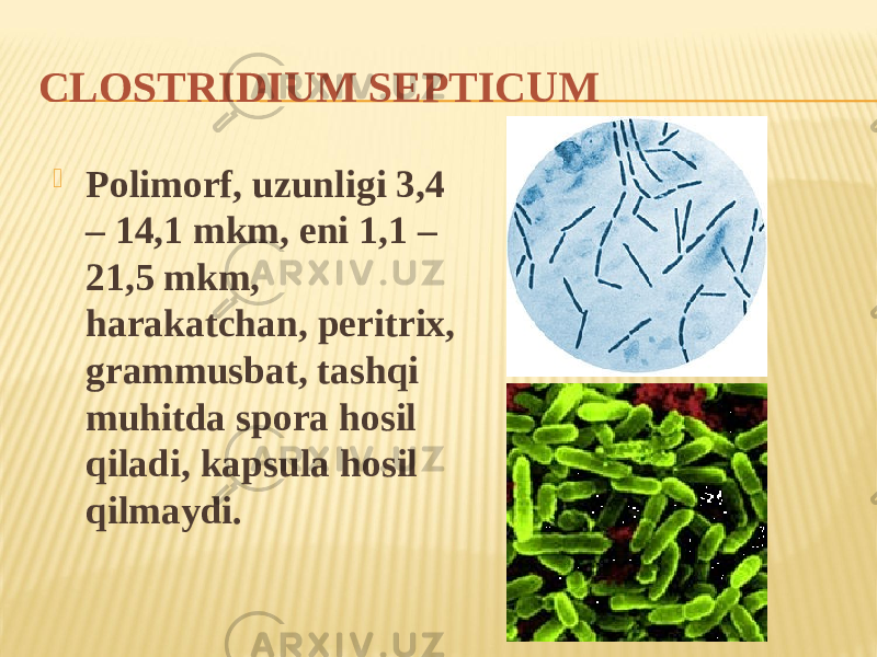 CLОSTRIDIUM SEPTICUM  Polimorf, uzunligi 3,4 – 14,1 mkm, eni 1,1 – 21,5 mkm, harakatchan, peritrix, grammusbat, tashqi muhitda spora hosil qiladi, kapsula hosil qilmaydi. 