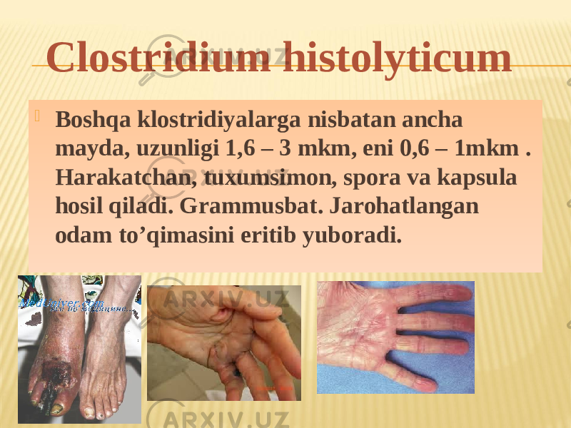  Boshqa klostridiyalarga nisbatan ancha mayda, uzunligi 1,6 – 3 mkm, eni 0,6 – 1mkm . Harakatchan, tuxumsimon, spora va kapsula hosil qiladi. Grammusbat. Jarohatlangan odam toʼqimasini eritib yuboradi.Clostridium histolyticum 