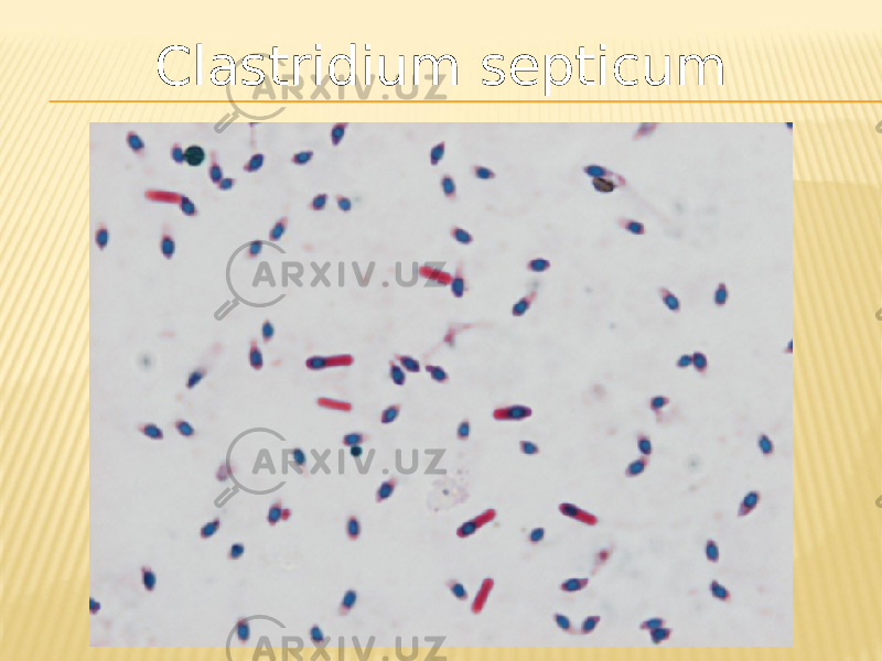 Clastridium septicum 