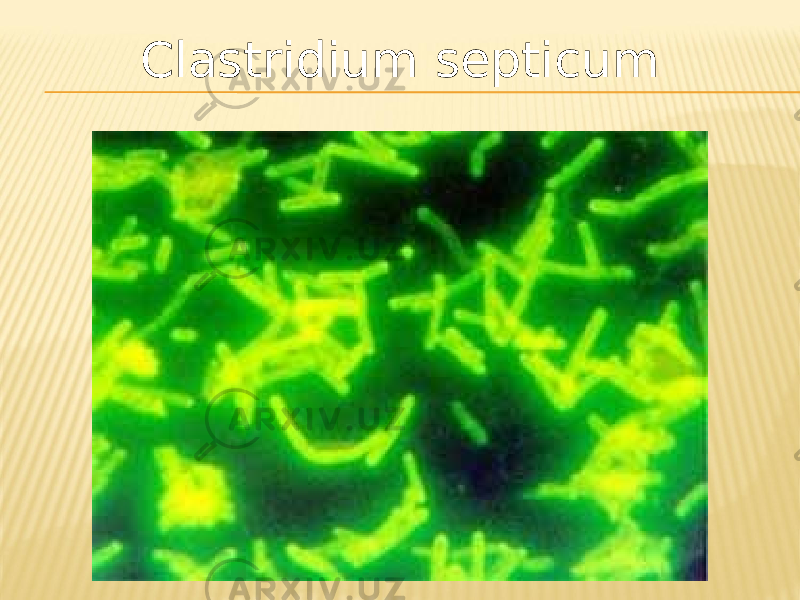 Clastridium septicum 