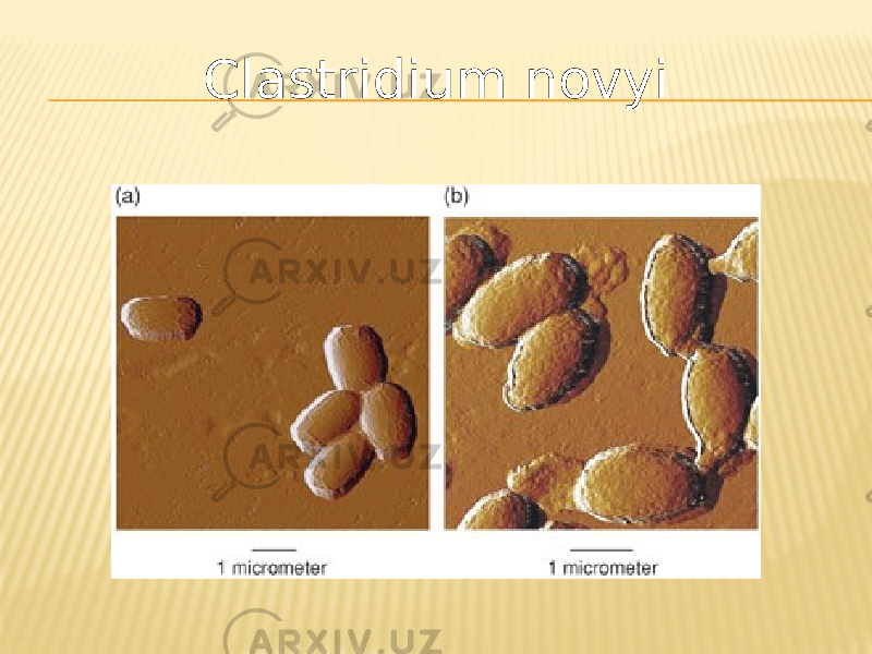 Clastridium novyi 