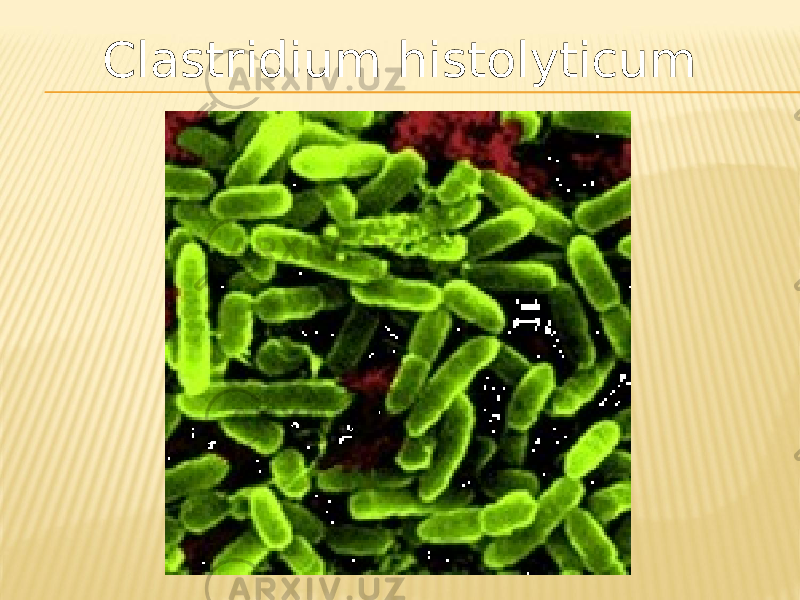 Clastridium histolyticum 