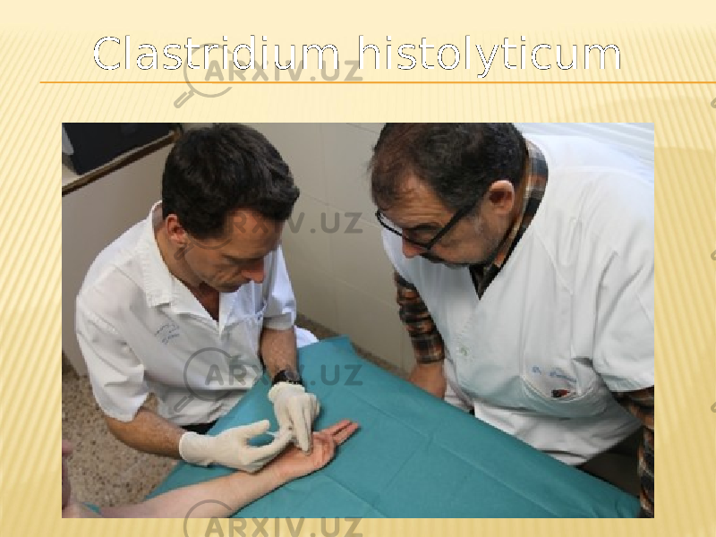 Clastridium histolyticum 