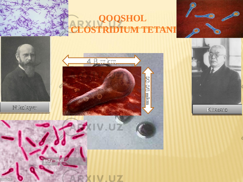 QOQSHOL CLOSTRIDIUM TETANI Nikolayer Kitazatо4-8 mkm0/3-0/8 m km07 17241B 