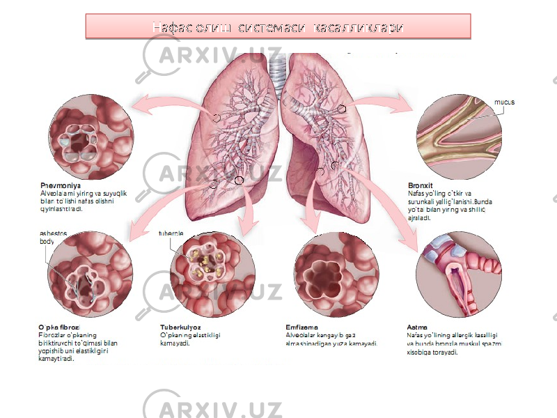 Нафас олиш системаси касалликлари1F 