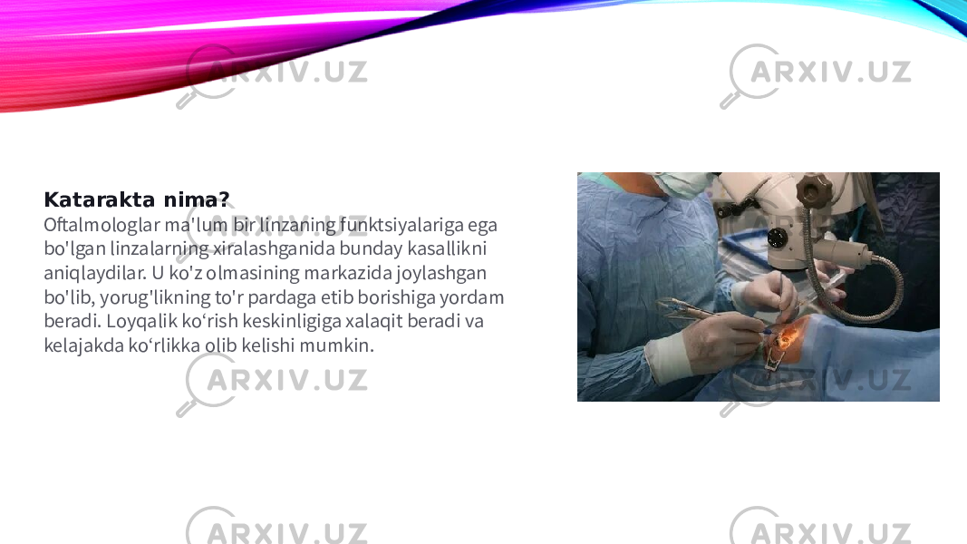 Katarakta nima? Oftalmologlar ma&#39;lum bir linzaning funktsiyalariga ega bo&#39;lgan linzalarning xiralashganida bunday kasallikni aniqlaydilar. U ko&#39;z olmasining markazida joylashgan bo&#39;lib, yorug&#39;likning to&#39;r pardaga etib borishiga yordam beradi. Loyqalik ko‘rish keskinligiga xalaqit beradi va kelajakda ko‘rlikka olib kelishi mumkin. 