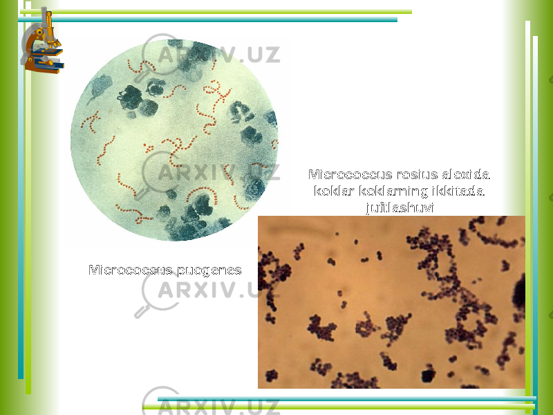 Micrococcus puogenes Micrococcus rosius aloxida koklar koklarning ikkitada juftlashuvi 