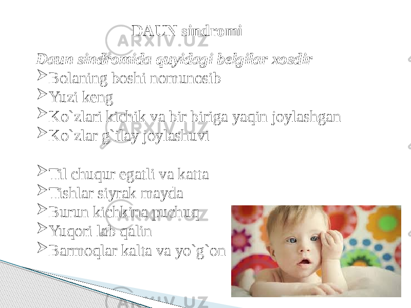 Daun sindromida quyidagi belgilar xosdir  Bolaning boshi nomunosib  Yuzi keng  Ko`zlari kichik va bir biriga yaqin joylashgan  Ko`zlar g`ilay joylashuvi  Til chuqur egatli va katta  Tishlar siyrak mayda  Burun kichkina puchuq  Yuqori lab qalin  Barmoqlar kalta va yo`g`on DAUN sindromi 