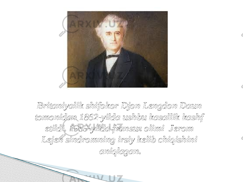 Britaniyalik shifokor Djon Lengdon Daun tomonidan 1862-yilda ushbu kasallik kashf etildi. 1959-yilda fransuz olimi Jerom Lejen sindromning irsiy kelib chiqishini aniqlagan. 