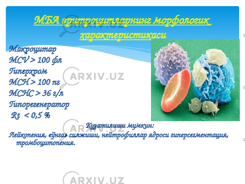 Макроцитар MCV > 100 фл Гиперхром MCH > 100 пг MCHC > 36 г/л Гипорегенератор Rt < 0,5 % Кузатилиши мумкин: Лейкопения, «ўнга» силжиши, нейтрофиллар ядроси гиперсегментация, тромбоцитопения. МБА эритроцитларнинг морфологик характеристикаси 