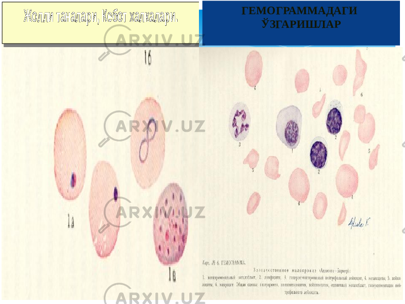 ГЕМОГРАММАДАГИ ЎЗГАРИШЛАРЖолли таналари , Кебот халкалари . Жолли таналари , Кебот халкалари . 