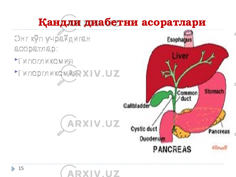 Қандли диабетни асоратлари Энг кўп учрайдиган асоратлар:  Гипогликемия  Гипергликемия 15 